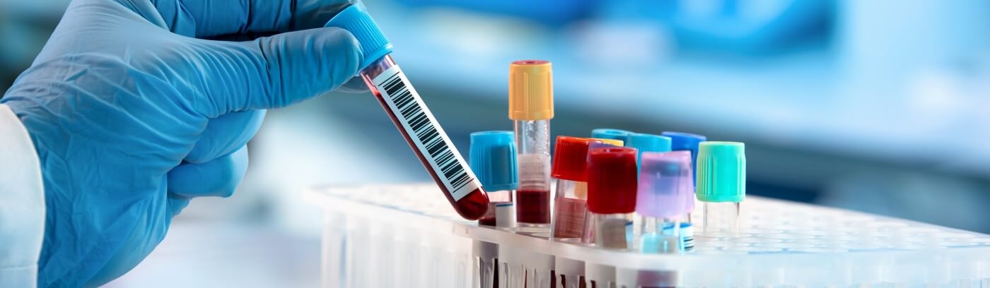 Functional Medicine Testing